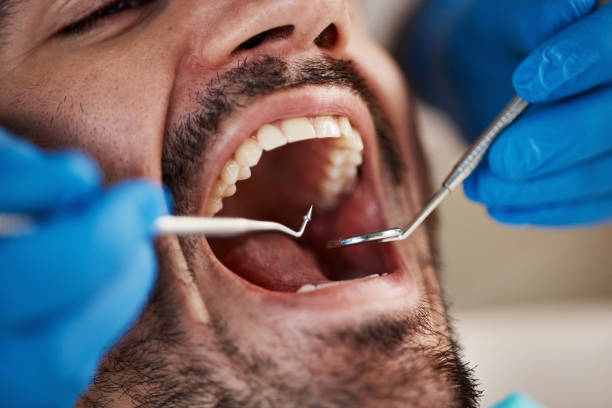 Best Emergency Dental Filling Replacement  in Niles, OH