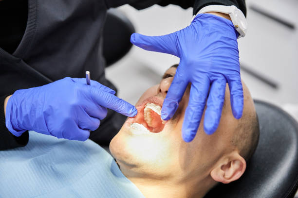 Best Chipped Tooth Repair Near Me  in Niles, OH